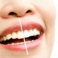 Smile Brighter with the Best Cosmetic Dentist in San Diego: Your Guide to Perfect Teeth